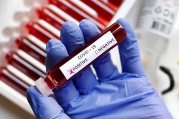 एक बार फिर सिंगापुर और हॉन्गकॉन्ग में बढ़ रहे कोविड के मामले, भारत में क्या है स्थिति जानिए…